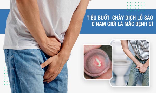 Tiểu buốt ở nam giới