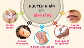 nguyên nhân bệnh xã hội