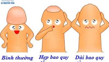 bao quy đầu hơi dài