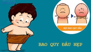 hẹp bao quy đầu ở trẻ