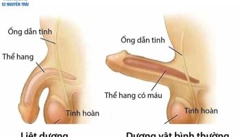 khám rối loạn cương dương