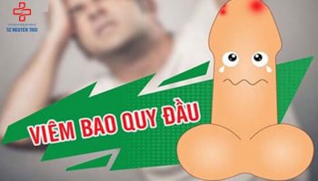 cách chữa viêm bao quy đầu