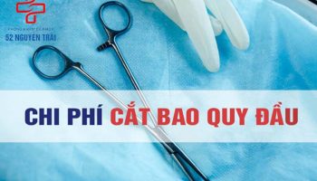 chi phí chữa và điều trị hẹp bao quy đầu