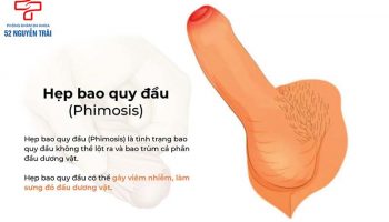 điều trị hẹp bao quy đầu