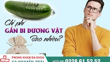 chi phí gắn bi bao nhiêu tiền