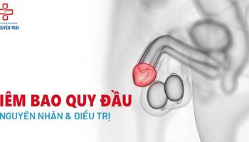 viêm bao quy đầu