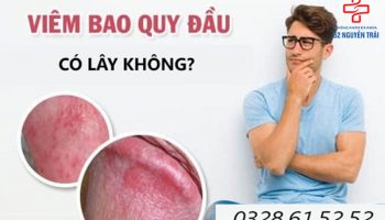 viêm bao quy đầu có lây không