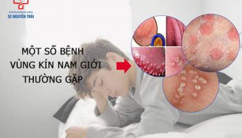 các bệnh ngoài da ở vùng kín nam giới