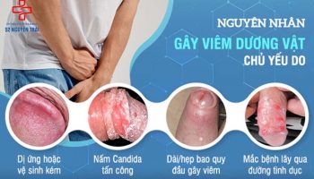 viêm dương vật