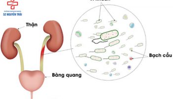 nhiễm trùng đường tiểu