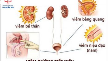 viêm đường tiết niệu có lây không