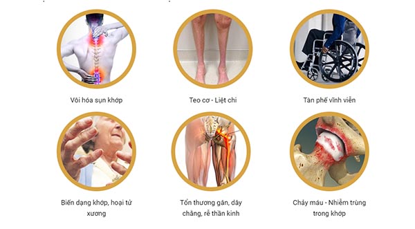 Danh sách các phòng khám cơ, xương khớp tốt tại Hà Nội