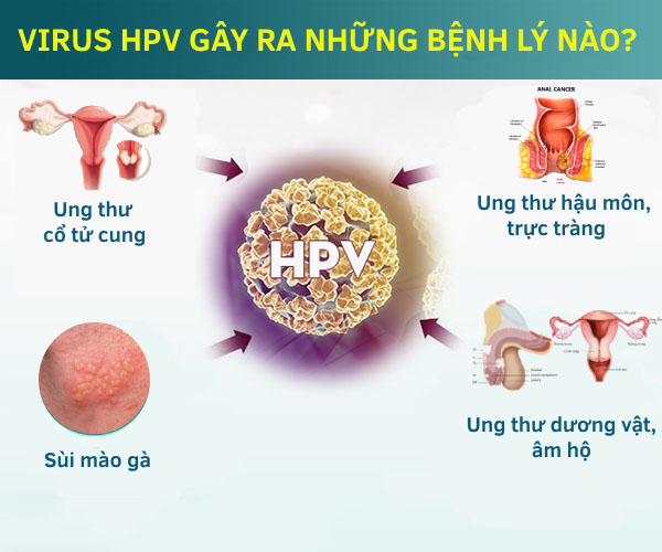 Virus HPV gây ra bệnh lý gì? Có nguy hiểm không?