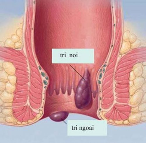 Ngứa hậu môn