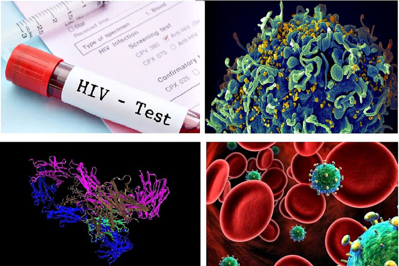 Chi Phí xét nghiệm hiv