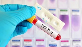 chi phí xét nghiệm hiv