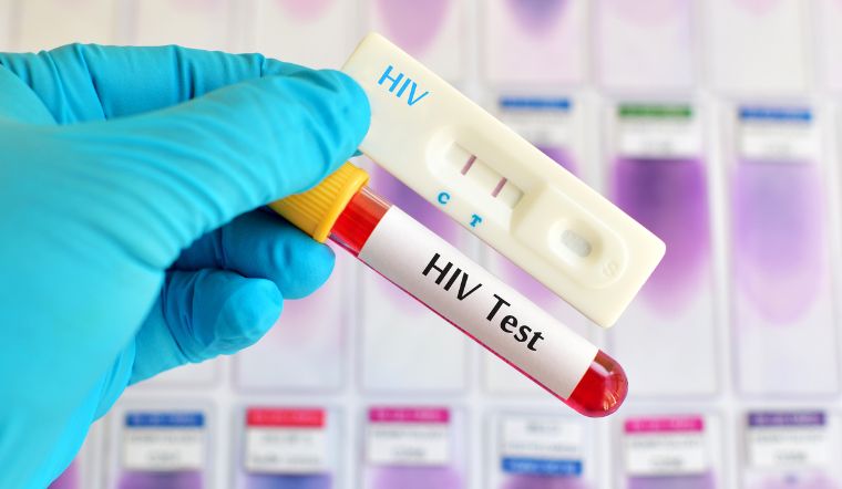 Sau Quan Hệ Bao Lâu Nên Xét Nghiệm HIV,  Chi Phí Bao Nhiêu Tiền? Địa chỉ xét nghiệm uy tín tại Hà Nội