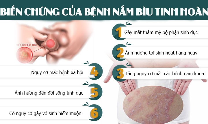 biến chứng khi bị nấm da bìu