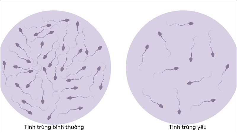 Kết quá xét nghiệm tinh dịch đồ