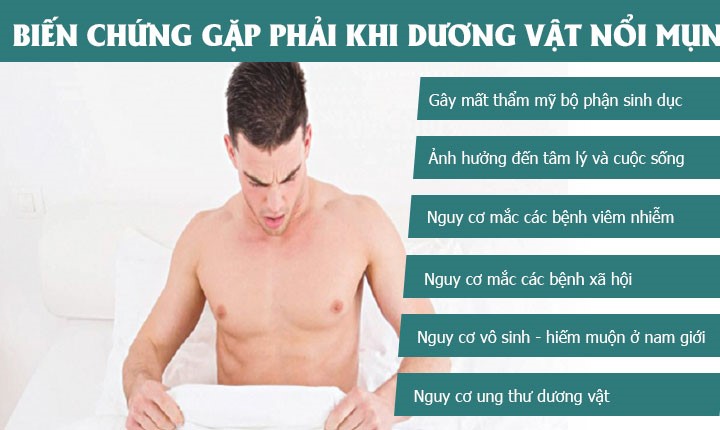 Nổi Mụn Ở Dương Vật – Dấu Hiệu Cảnh Báo Của Nhiều Bệnh Lý