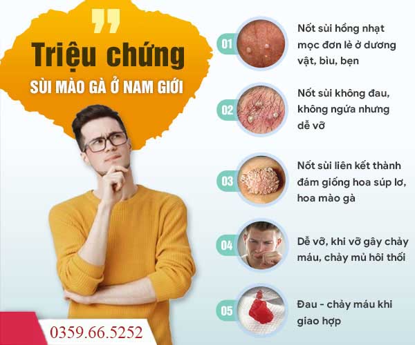 dấu hiệu sùi mào gà