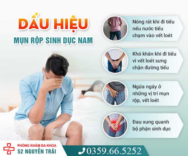 Mụn rộp sinh dục