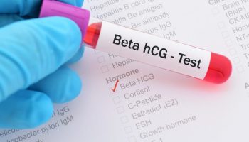 xét nghiệm beta hcg