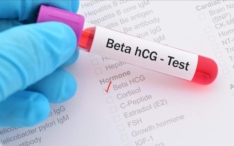 Xét nghiệm beta hCG bao nhiêu tiền và ở đâu?