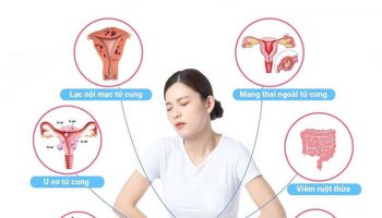 nguyên nhân đau bụng dưới