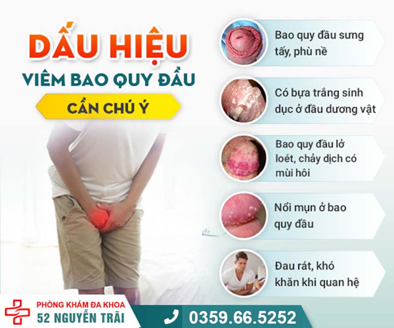 mun-bao-quy-dau-nam