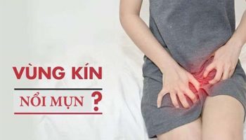vùng kín nữ nổi mụn