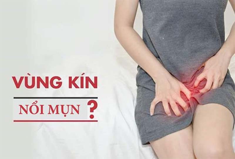 Nổi mụn ở “cô bé” có nguy hiểm không? Nguyên nhân và cách điều trị