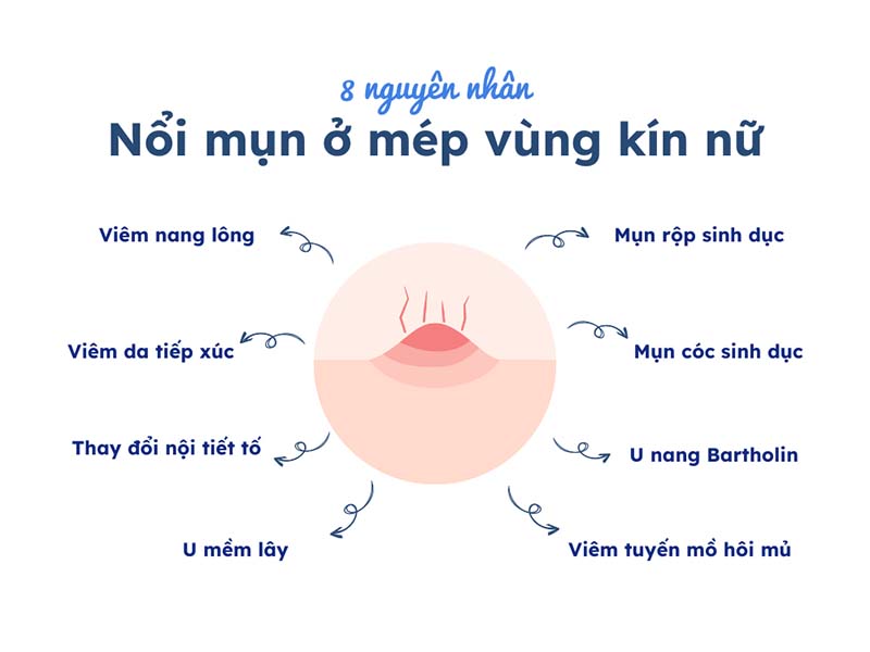 nguyên nhân nổi mụn vùng kín nữ