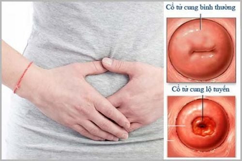 đau bụng dưới nữ