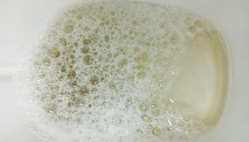 Nuốc tiểu có bọt