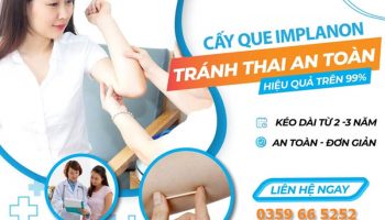 cấy que tránh thai
