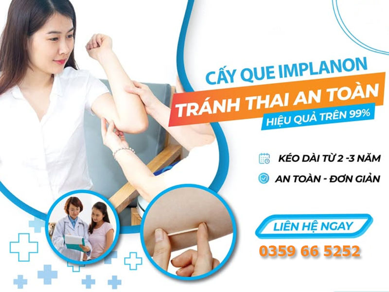 Cấy Que Tránh Thai Tại Hà Nội: Địa Chỉ Nào Uy Tín? Chi Phí Thực Hiện Bao Nhiêu Tiền?