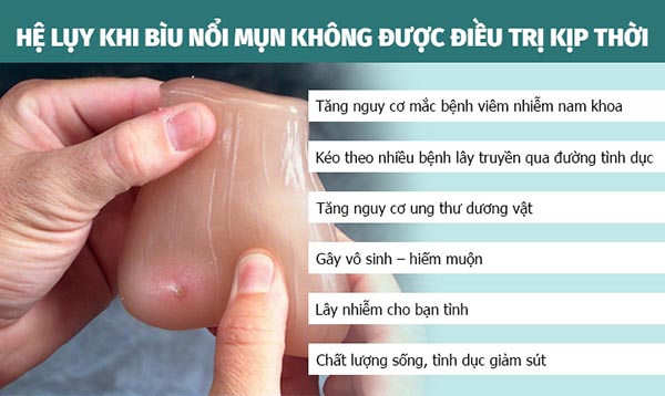 Nguyên nhân nổi mụn ở vùng da bìu và cách điều trị hiệu quả