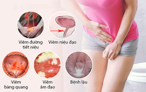 nguyên nhân tiểu buốt ở nữ