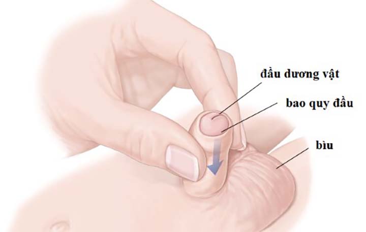 Nong Bao Quy Đầu Cho Bé Ở Đâu Tại Hà Nội tham khảo địa chỉ uy tín