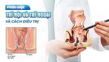 khám bệnh trĩ