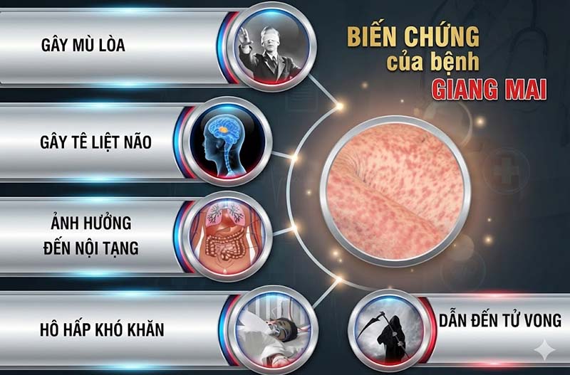 biến chứng của bệnh giang mai