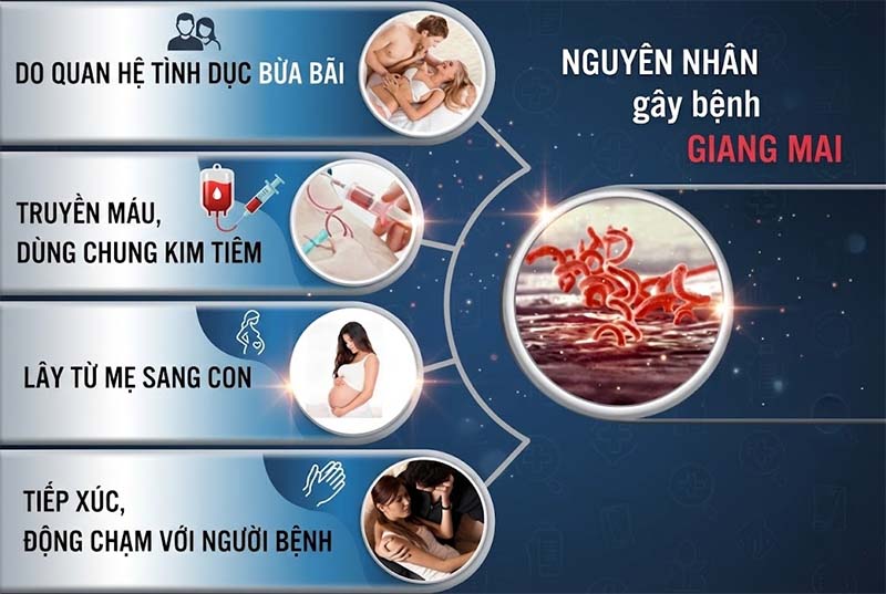 nguyên nhân gây bệnh giang mai