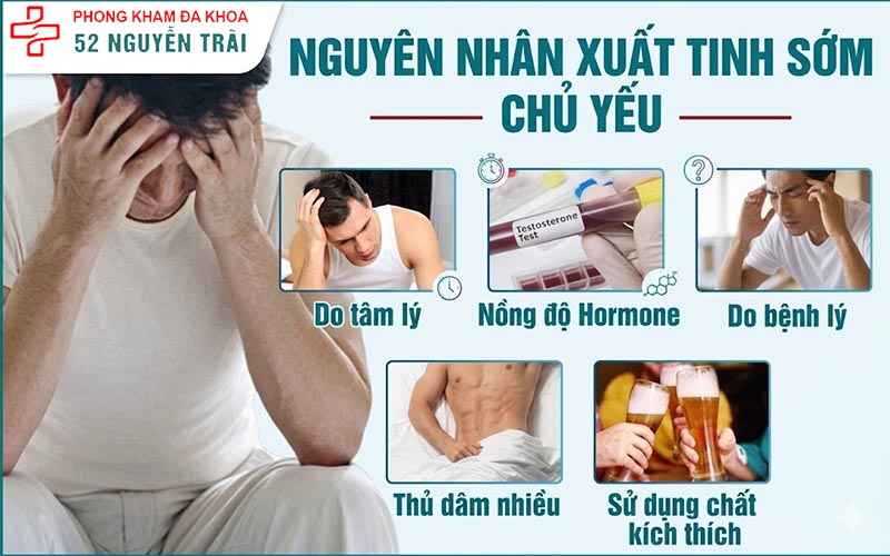 Nguyên nhân xuất tinh sớm