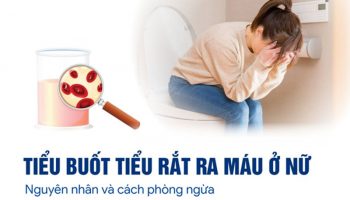 TIỂU BUỐT RA MÁU
