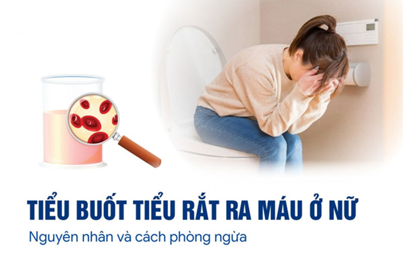 TIỂU BUỐT RA MÁU
